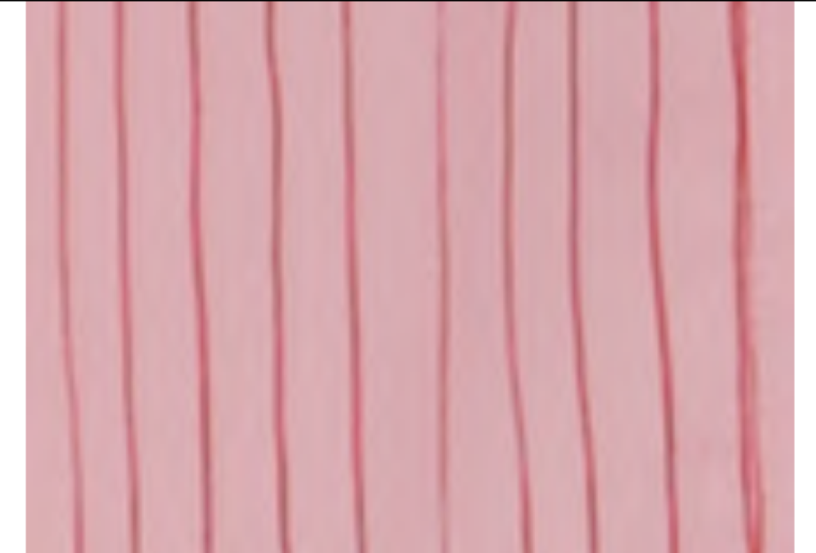 Foemina Franki Dress - Lolly Stripe